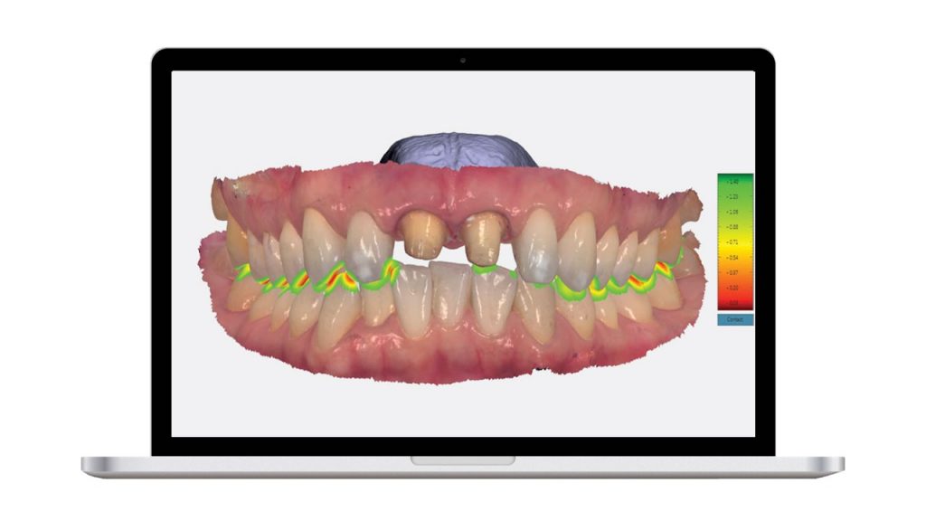 Trios Pod Scanner – MAC Digital Dental Systems LLC