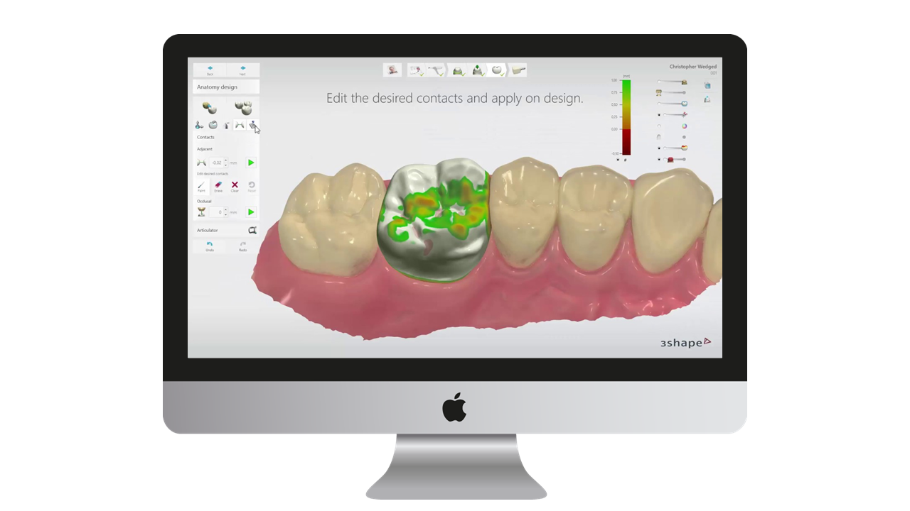 3D IntraOral Scanners – MAC Digital Dental Systems LLC