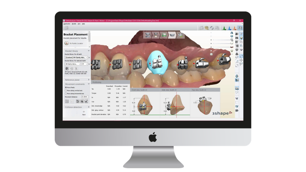 3D IntraOral Scanners – MAC Digital Dental Systems LLC